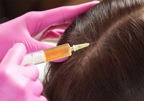 GFC Treatment